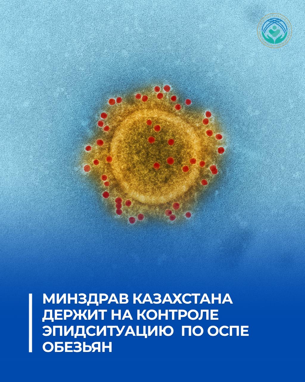 МИНЗДРАВ КАЗАХСТАНА ДЕРЖИТ НА КОНТРОЛЕ ЭПИДСИТУАЦИЮ ПО ОСПЕ ОБЕЗЬЯН