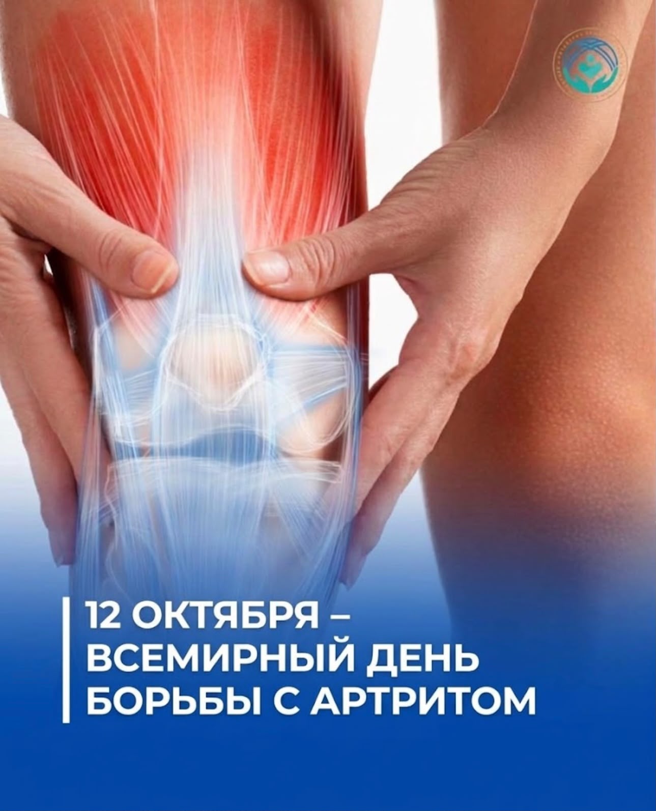 112 ОКТЯБРЯ – ВСЕМИРНЫЙ ДЕНЬ БОРЬБЫ С АРТРИТОМ